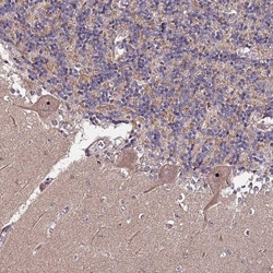KRI1 Antibody, Novus Biologicals 0.1mL; Unlabeled:Antibodies, Polyclonal
