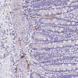 KRIT1 Antibody, Novus Biologicals:Antibodies:Primary Antibodies