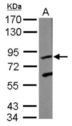 KRIT1 Antibody, Novus Biologicals 0.1mL; Unlabeled:Antibodies, Polyclonal