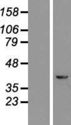 Novus Biologicals&trade;&nbsp;KRR1 Overexpression Lysate