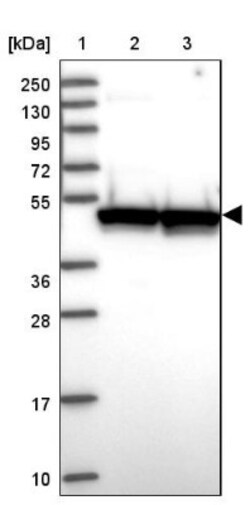 KRR1 Antibody, Novus Biologicals 25 &mu;L, Unconjugated:Antibodies, Polyclonal