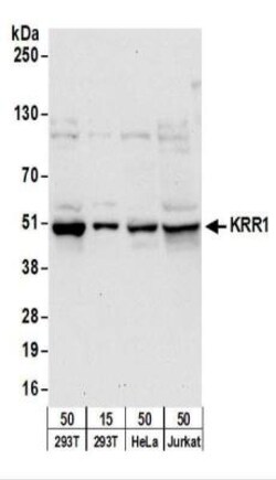 KRR1 Antibody, Novus Biologicals 0.1mg; Unlabeled:Antibodies, Polyclonal