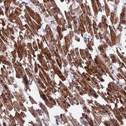 KRT222 Antibody, Novus Biologicals 0.1mL; Unlabeled:Antibodies, Polyclonal