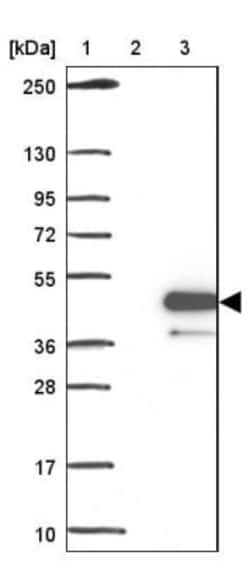 KRT222 Antibody, Novus Biologicals 0.1mL; Unlabeled:Antibodies, Polyclonal