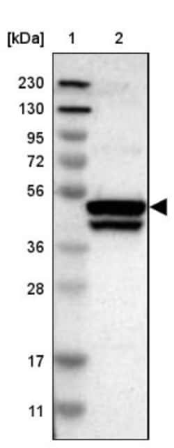 KRT23 Antibody, Novus Biologicals:Antibodies:Primary Antibodies