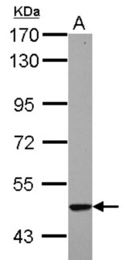 KRT23 Antibody, Novus Biologicals 0.1mL; Unlabeled:Antibodies, Polyclonal