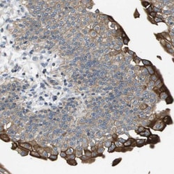 KRT23 Antibody, Novus Biologicals:Antibodies:Primary Antibodies