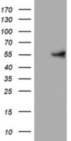 KRT24 Antibody (OTI4E8), Novus Biologicals 0.1mL; Unlabeled:Antibodies,
