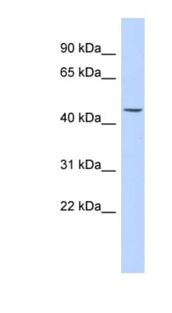 KRT24 Antibody, Novus Biologicals 20&mu;L; Unlabeled:Antibodies, Polyclonal
