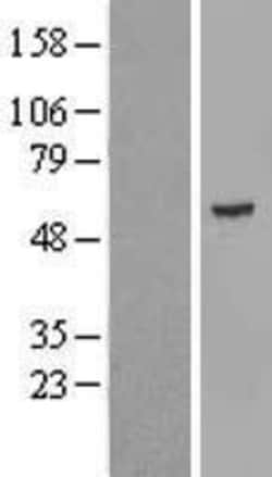 Novus Biologicals&trade;&nbsp;KRT24 Overexpression Lysate