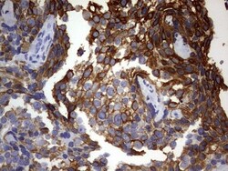 KRT24 Antibody (OTI4E8), Novus Biologicals 0.1mL; Unlabeled:Antibodies,