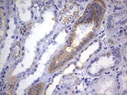 KRT24 Antibody (OTI4E8), Novus Biologicals 0.1mL; Unlabeled:Antibodies,
