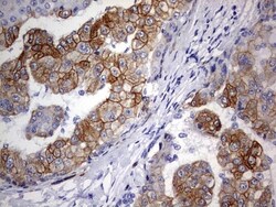 KRT24 Antibody (OTI4E8), Novus Biologicals 0.1mL; Unlabeled:Antibodies,
