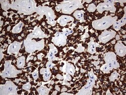 KRT24 Antibody (OTI4E8), Novus Biologicals 0.1mL; Unlabeled:Antibodies,