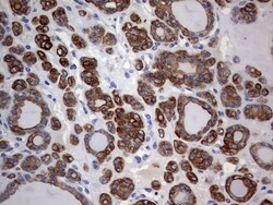 KRT24 Antibody (OTI4E8), Novus Biologicals 0.1mL; Unlabeled:Antibodies,