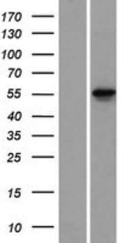 Novus Biologicals&trade;&nbsp;KRT78 Overexpression Lysate