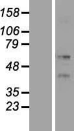 Novus Biologicals™ KRT86 Overexpression Lysate