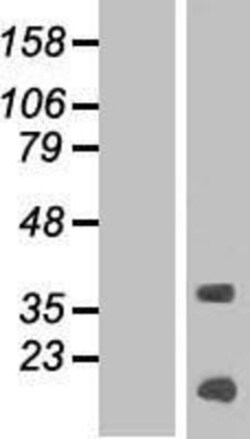 Novus Biologicals&trade;&nbsp;KRTAP13-4 Overexpression Lysate
