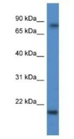KRTAP1-5 Antibody, Novus Biologicals 100&mu;L; Unlabeled:Antibodies, Polyclonal