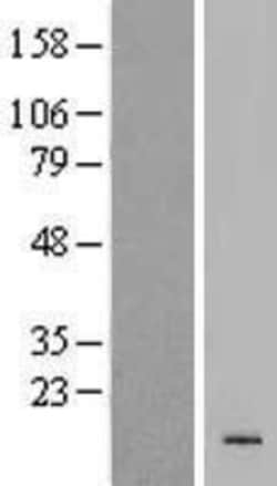 Novus Biologicals&trade;&nbsp;KRTAP19-4 Overexpression Lysate