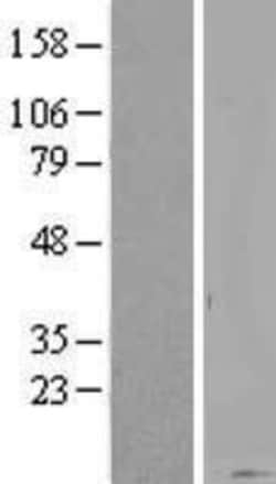 Novus Biologicals™ KRTAP20-1 Overexpression Lysate