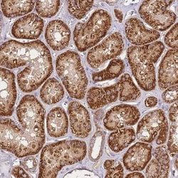 KRTAP21-3 Antibody, Novus Biologicals 25 &mu;L, Unlabeled:Antibodies, Polyclonal