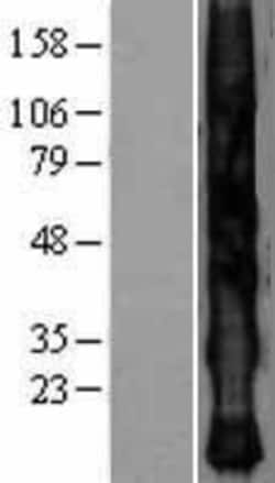 Novus Biologicals&trade;&nbsp;KRTAP2-4 Overexpression Lysate