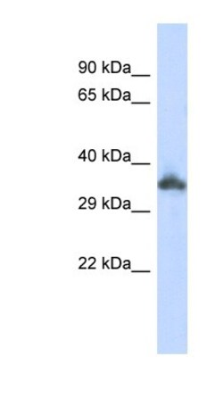 KRTAP24-1 Antibody, Novus Biologicals 100 &mu;L | Buy Online | Novus Biologicals | Fisher Scientific