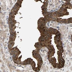 KRTAP27-1 Antibody, Novus Biologicals:Antibodies:Primary Antibodies