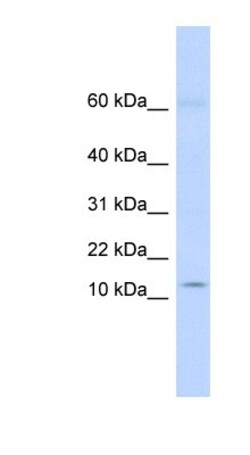KRTAP8-1 Antibody, Novus Biologicals 100&mu;L; Unlabeled:Antibodies, Polyclonal