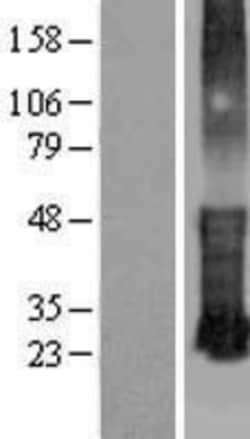 Novus Biologicals™ KRTCAP3 Overexpression Lysate