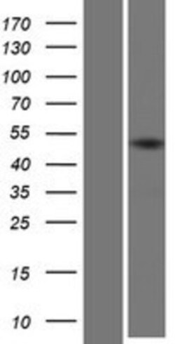 Novus Biologicals™ KRTHA2 Overexpression Lysate