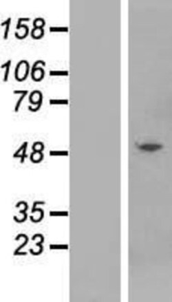 Novus Biologicals&trade;&nbsp;KRTHB3 Overexpression Lysate