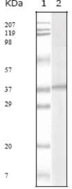 KSHV ORF62 Antibody (5B7B6), Novus Biologicals 0.1mL; Unlabeled:Antibodies,