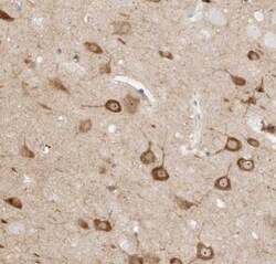 KSR2 Antibody, Novus Biologicals 0.1mL; Unlabeled:Antibodies, Polyclonal
