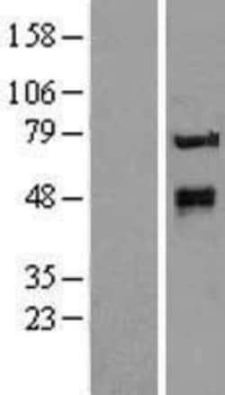 Novus Biologicals&trade;&nbsp;Protein O-Glucosyltransferase 1/POGLUT1/KTELC1 Overexpression Lysate