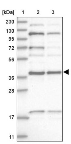 KTI12 Antibody, Novus Biologicals 25 &mu;L; Unlabeled:Antibodies, Polyclonal