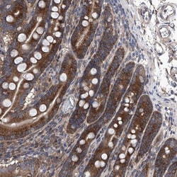 KTI12 Antibody, Novus Biologicals 25 &mu;L; Unlabeled:Antibodies, Polyclonal