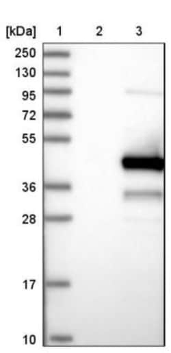 KTI12 Antibody, Novus Biologicals 0.1mL; Unlabeled:Antibodies, Polyclonal