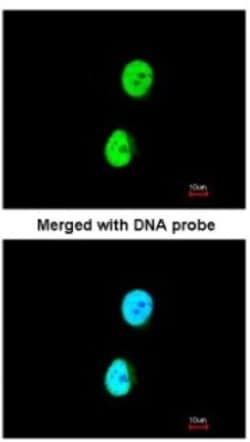 Ku70/XRCC6 Antibody, Novus Biologicals 0.1 mL | Buy Online | Novus Biologicals | Fisher Scientific