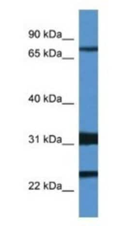 Kv4.1 Antibody, Novus Biologicals 100&mu;L; Unlabeled:Antibodies, Polyclonal