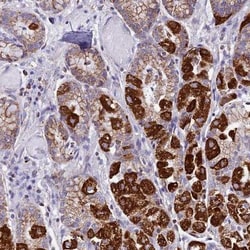 Kv6.1 Antibody, Novus Biologicals:Antibodies:Primary Antibodies