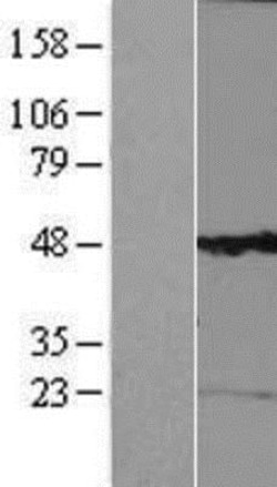 Novus Biologicals&trade;&nbsp;Kv6.1 Overexpression Lysate