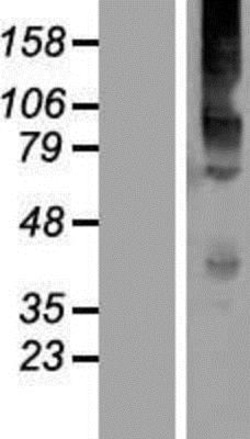 Novus Biologicals&trade;&nbsp;Kv6.4 Overexpression Lysate