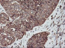 KvBeta1 Antibody (OTI4E7), Novus Biologicals 0.1mL; Unlabeled:Antibodies,