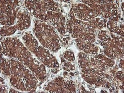 KvBeta1 Antibody (OTI4E7), Novus Biologicals 0.1mL; Unlabeled:Antibodies,
