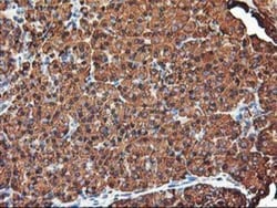KvBeta1 Antibody (OTI4E7), Novus Biologicals 0.1mL; Unlabeled:Antibodies,
