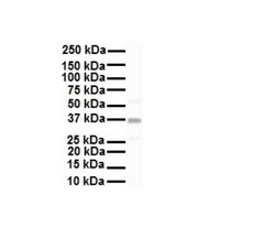 KvBeta2 Antibody, Novus Biologicals 0.1mg; Unlabeled:Antibodies, Polyclonal