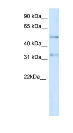 KvBeta2 Antibody, Novus Biologicals 100&mu;L; Unlabeled:Antibodies, Polyclonal
