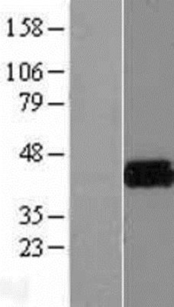 Novus Biologicals™ KvBeta2 Overexpression Lysate